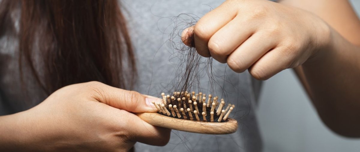 Erblich bedingter Haarausfall - IMPERIO COSMETICS
