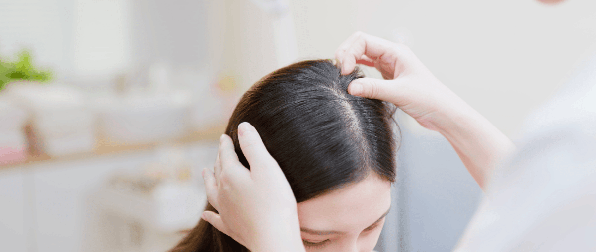 Haarausfall Ursachen - IMPERIO COSMETICS