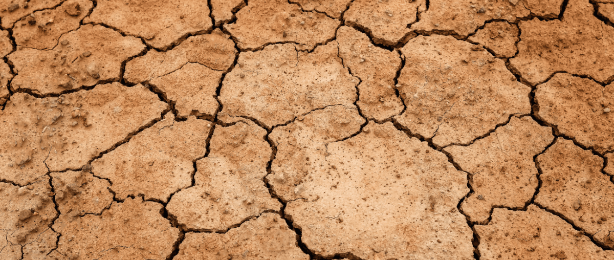 Trockener Haaransatz? Das hilft für Kopfhaut & Haare! - IMPERIO COSMETICS