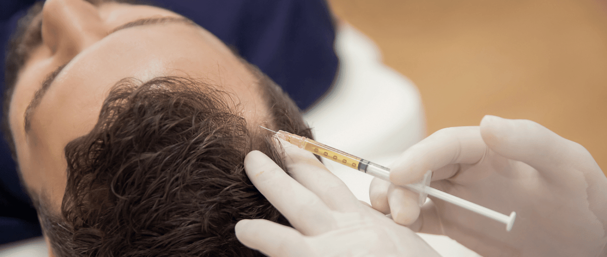 Was tun gegen Haarausfall? - IMPERIO COSMETICS