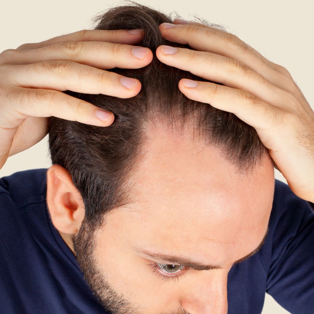 Geheimratsecken kaschieren - IMPERIO COSMETICS