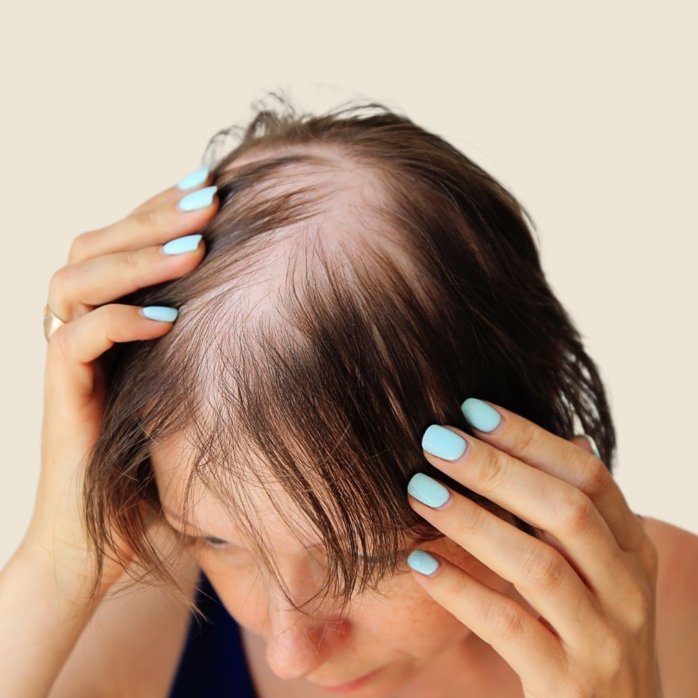 Kahle Stellen verdichten - IMPERIO COSMETICS