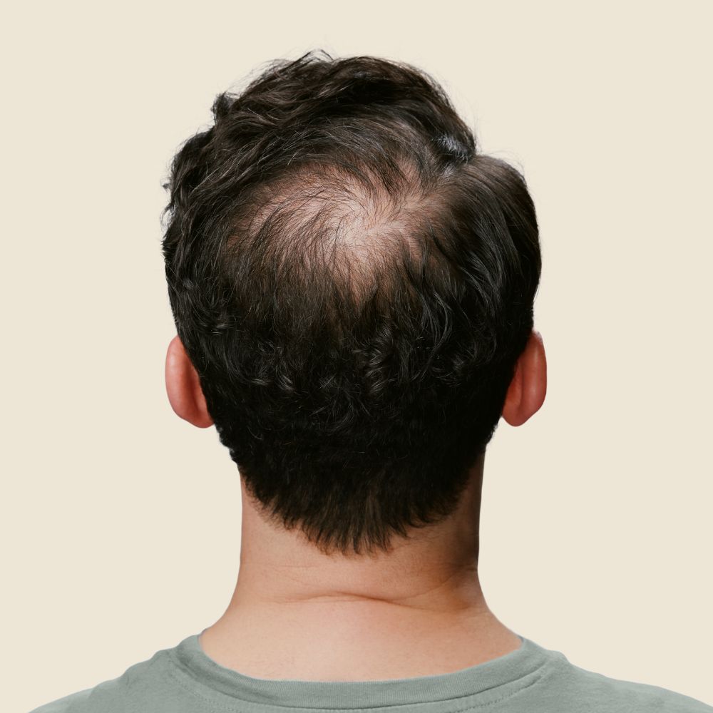 Oberkopf kaschieren - IMPERIO COSMETICS