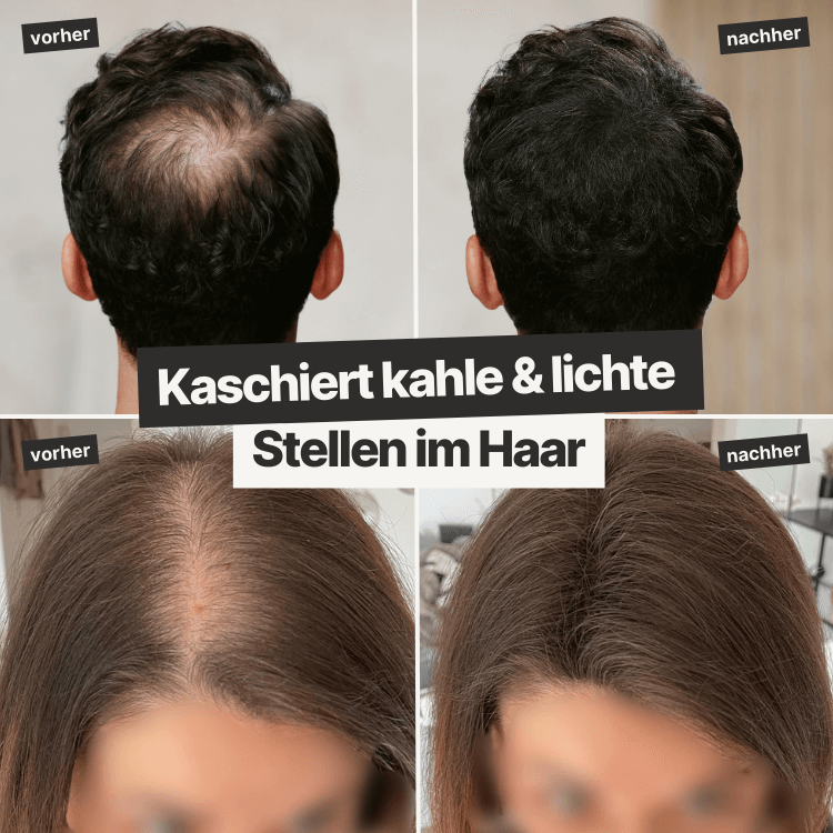2 Dosen IMPERIO® Streuhaar + 1 Gratis Dose (Aktion) - IMPERIO COSMETICS