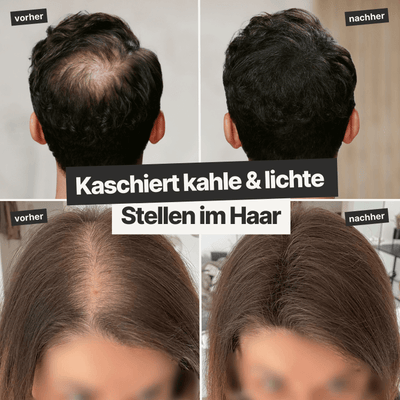 6 Dosen IMPERIO® Streuhaar + 2 Gratis Dosen | (Sparangebot M) - IMPERIO COSMETICS