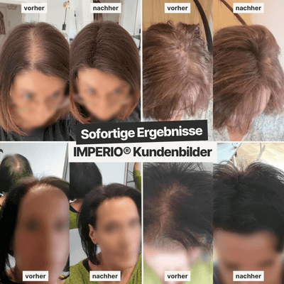 6 Dosen IMPERIO® Streuhaar + 2 Gratis Dosen | (Sparangebot M) - IMPERIO COSMETICS