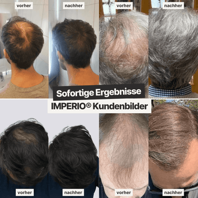 6 Dosen IMPERIO® Streuhaar + 2 Gratis Dosen | (Sparangebot M) - IMPERIO COSMETICS