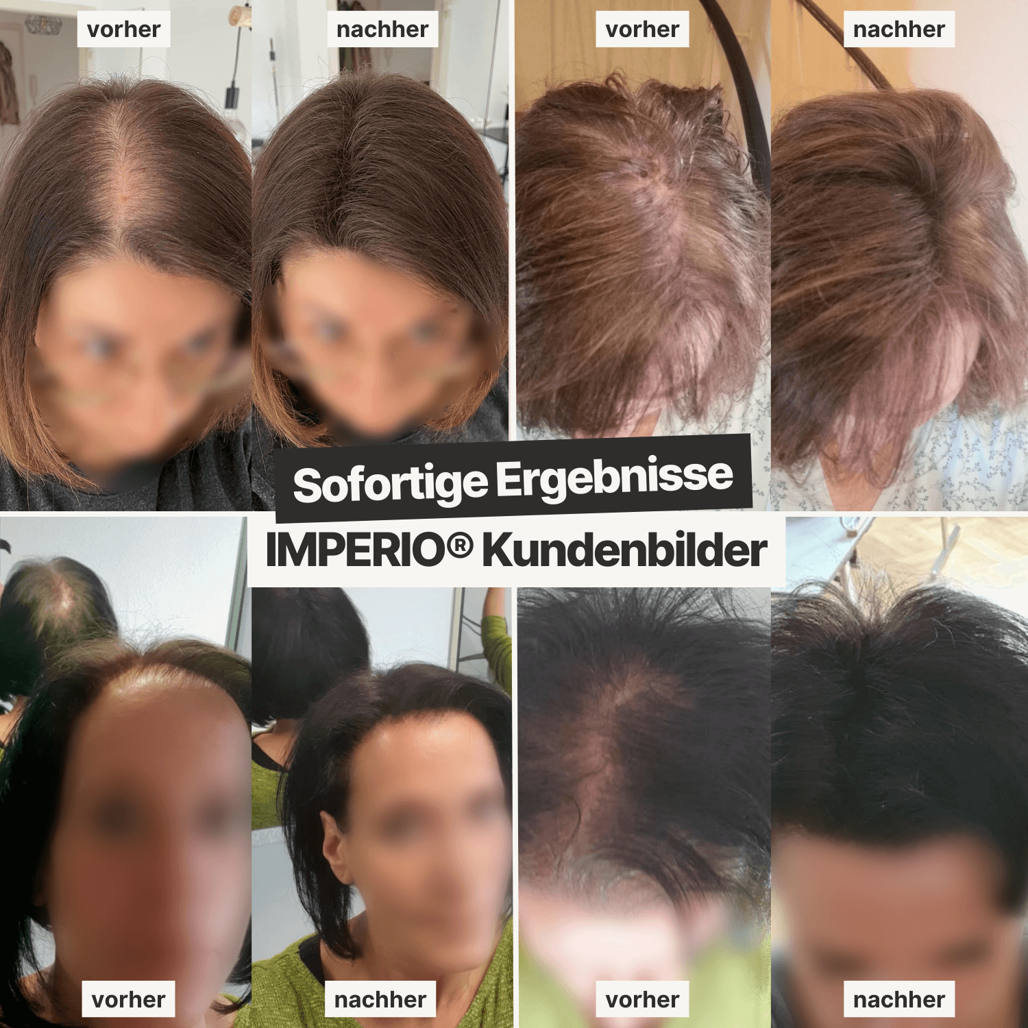 IMPERIO® Streuhaar | Volles Haar in 20 Sekunden