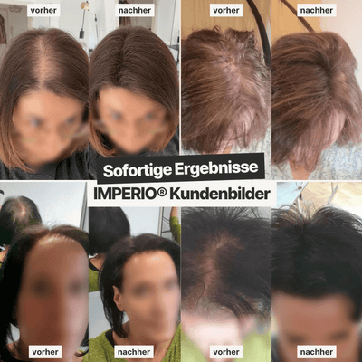 Ansatzpuder & Streuhaar Kombi - Set - IMPERIO COSMETICS