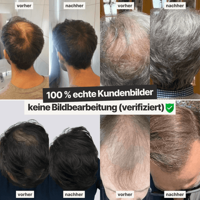 streuhaar kundenbilder