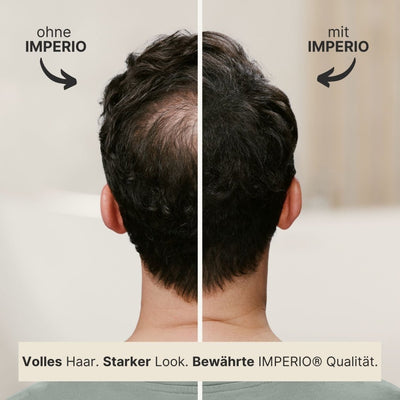 IMPERIO® Streuhaar Refill Pack - IMPERIO COSMETICS